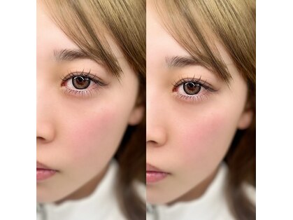 チュチュアチュチュ(chuchu a chuchu)の写真