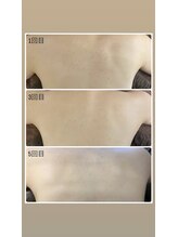 モルティー 広島店(Molti)/ブライダルエステ