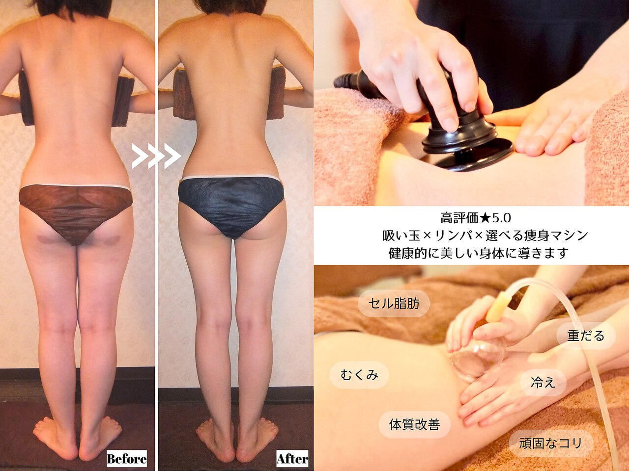 エステティックサロンティエリー｜ホットペッパービューティー