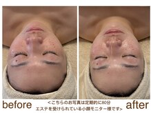 ルル リラクゼーション(RURU Relaxation)/小顔リフト