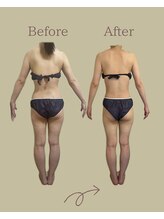 レン サロン(REN.)/【ブライダル】痩身×整体