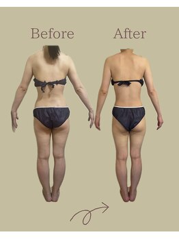 レン サロン(REN.)/【ブライダル】痩身×整体