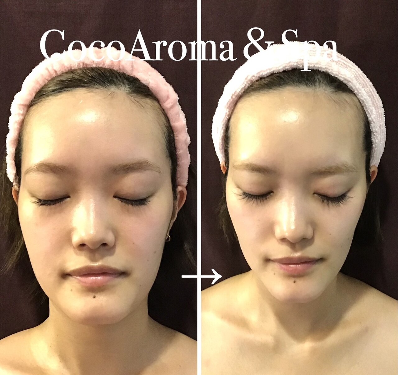 ラヴィアンローズ(Lavie en Rose)｜ホットペッパービューティー