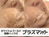 【ニキビ/シワ/くすみ/ハリ弾力】プラズマシャワーで本気の肌質改善!!