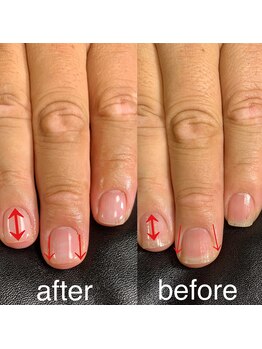 アトリエ ムーン(ATELIER Moon)/【自爪育成】