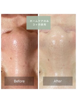 ビューティーサロン エー(A)/化粧品使用〈ビフォーアフター〉