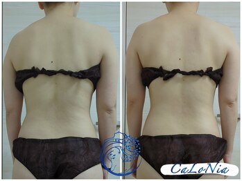 カロニア(CaLoNia)/一度でもスッキリボディへ☆