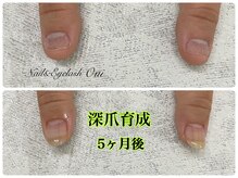 ウイ(Oui)/深爪育成