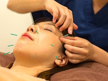 からだ整体院 三宮院/施術＜＜プラチナ美容鍼＞＞