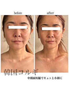 プレジール(Plaisir)/韓国コルギ