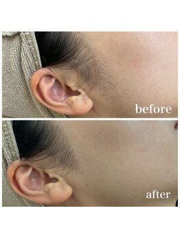 ラクシー 御徒町(luxssy)/顔シェービング