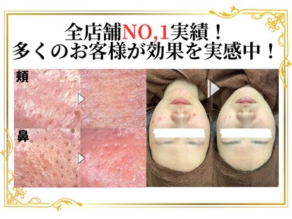 ベベ 高崎本店(Be'be')の写真