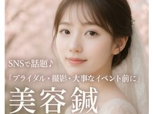 モッチ 天神大名店(MOCCHI)の雰囲気（イベント前の駆け込みに。小顔効果◎美容鍼／天神）