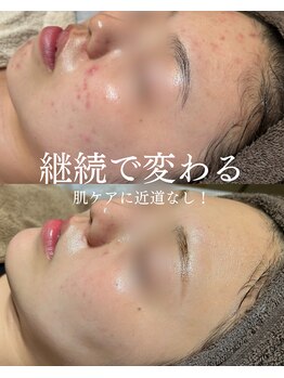 インテリウス(INteRius.)/継続で変わる