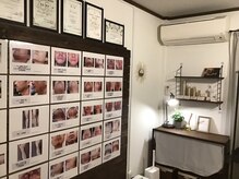 メンズ ユシュレ(Men's YUSYURE)の雰囲気(ビフォーアフターの写真多数あり♪【メンズ脱毛】)