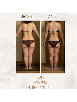 エメカシワ(Aimer KASHIWA)/50代　4ヶ月での変化