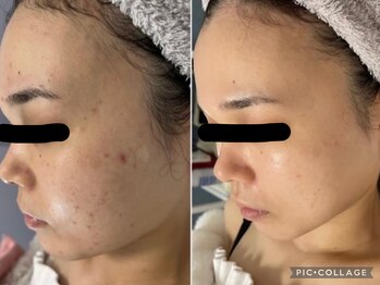 ラヴィアンローズ 津島店(La vie en Rose)/◇ビフォーアフター◇