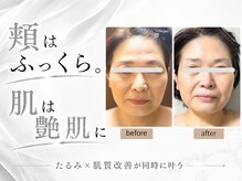 グロウ バイ フェイシャルデザイン アンド アイ(GROW)