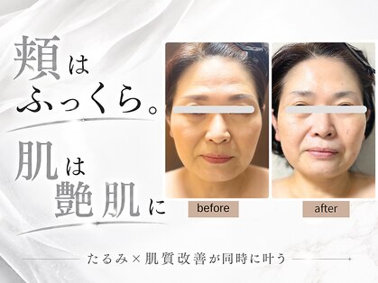 グロウ バイ フェイシャルデザイン アンド アイ(GROW)の写真