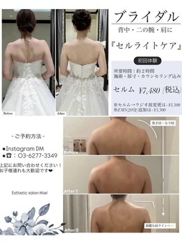 ミエル 恵比寿店(Miel)の写真/【一生に一度だから、結果に妥協しない】12年磨いたハンド×マシンで二の腕・背中を集中ケア！
