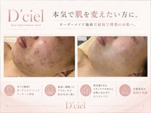 ディシエル(D'ciel)