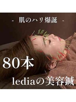 ルディア 堀江店(ledia)/贅沢!80本の美容鍼で究極の美肌
