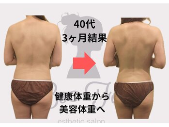 ビーフォー(be for)/40代　3ヶ月６回コース結果