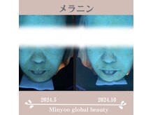 ミニョ コリアンビューティー(Minyoo korean beauty)の雰囲気（最新のAI肌診断で定期的に肌内部をチェックし肌悩みを根本改善！）