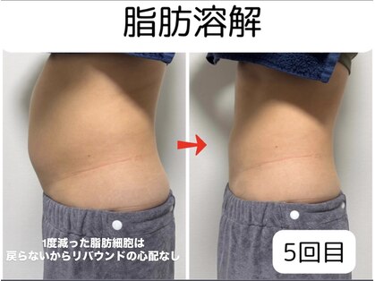 ユニヴェール(univers)の写真