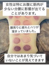 リベル(Liber)/カッピングで見えることも