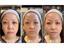 「いま整えるキレイが、これからの私をつくっていく。」