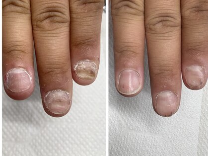 ブルームーンネイルズ(BLOOMOON.nails)の写真