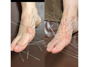 アイリス鍼灸マッサージ 上野院(Iris鍼灸マッサージ)/女性に多い。