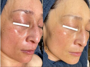 ポ ワール(Poir)/