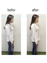 アオバダイ整体院/整体/小顔矯正/自律神経