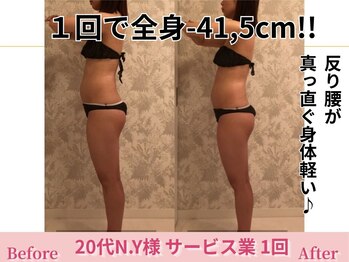 アメリイ 百合ヶ丘 新百合ヶ丘(Amerii)/【20代痩身】1回全身-41.5cm痩せ