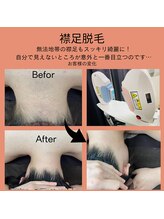 ベルミ―ランド いなげや大和相模大塚/襟足脱毛