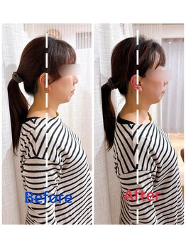 イズム まつもと店(izm)/小顔モニター様