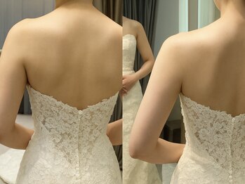 上野エステサロン レア(Lea)の写真/【上野トップクラス◇セル脂肪撃退！】挙式を控えた花嫁さん必見♪全国痩身コンテスト入賞の実力派サロン！