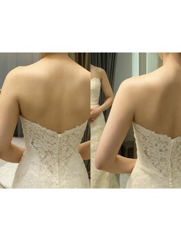 ブライダルメニューがあるサロン