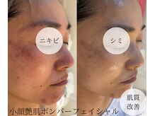 サロンパッテデシャット(salon patte de chat)の雰囲気（小顔/リフトアップ/ニキビケア/乾燥肌などの肌質改善/毛穴ケアも）