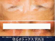 エヴァーグレース 栄店