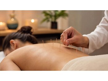 高輪AC Wellness Salon【AcupunCouture 】アキュパンクチュールの写真/【女性鍼灸師対応】《鍼灸×整体》で健康美を叶えながら不調改善&美姿勢に*ブライダル/肩こり/猫背ケア◎