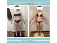 ニュウミー 諏訪本店(newme)/お客様ビフォーアフター
