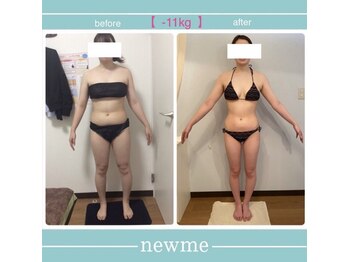 ニュウミー 諏訪本店(newme)/お客様ビフォーアフター