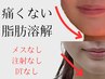【二重あご・えら張りに】圧倒的★脂肪分解小顔コース60分今だけ50％オフ