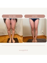 テン エイト(10 8)/太ももの外張り撃退