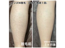 ネイキッドベージュ 恵比寿店(Naked Beige)の雰囲気（落ち着いた癒しの空間でリラックスしながら施術を受けられます♪）