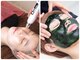 ドクター小顔 銀座店(Dr.小顔)の写真/シミしわ/ニキビ/毛穴悩み改善★医療提携サロンで本気の肌ケア！
ハーブピーリング＋美肌マシン9800円
