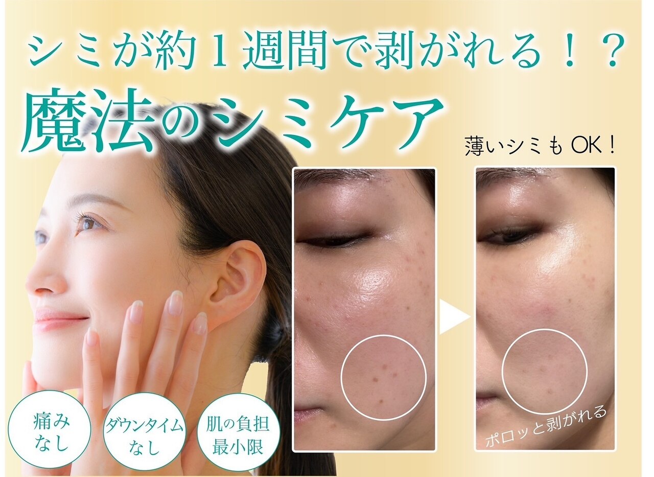 【本気のシミケアNO1】シミ改善◎デトックスフェイシャル60分18,000→8,800